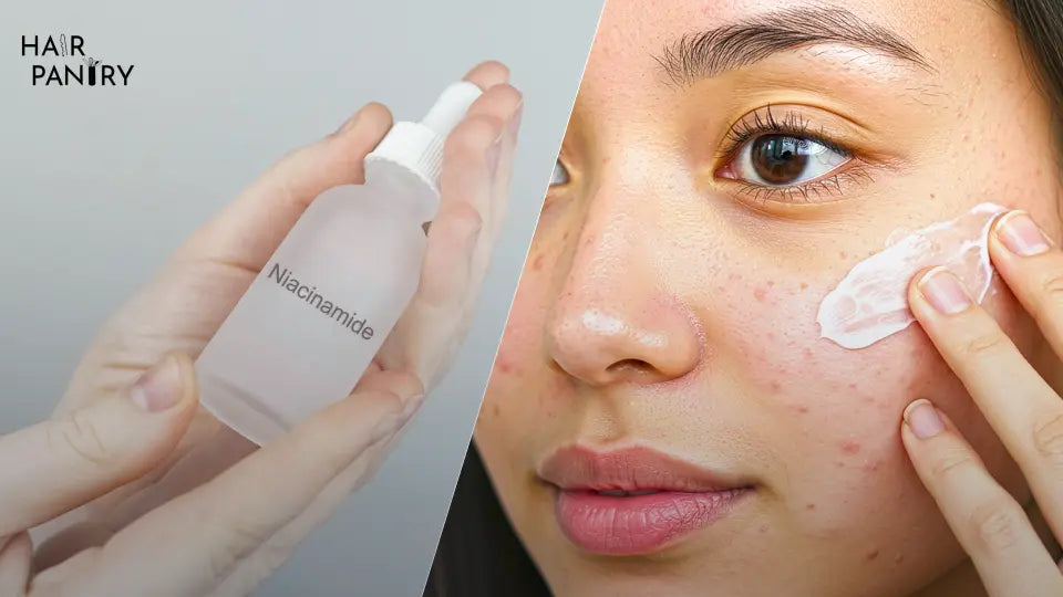 Niacinamide vs Other Anti-Acne Ingredients