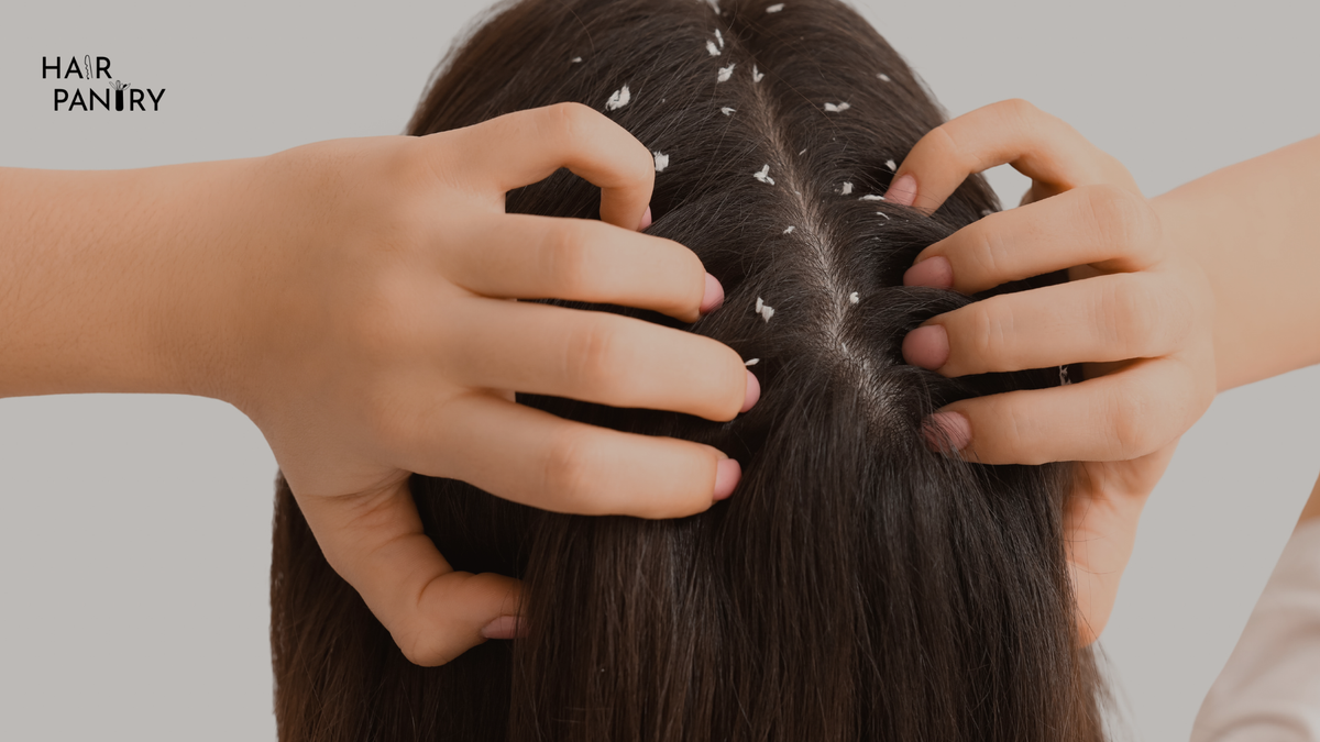 Reasons to Try Medicated Anti Dandruff Shampoo This Winter