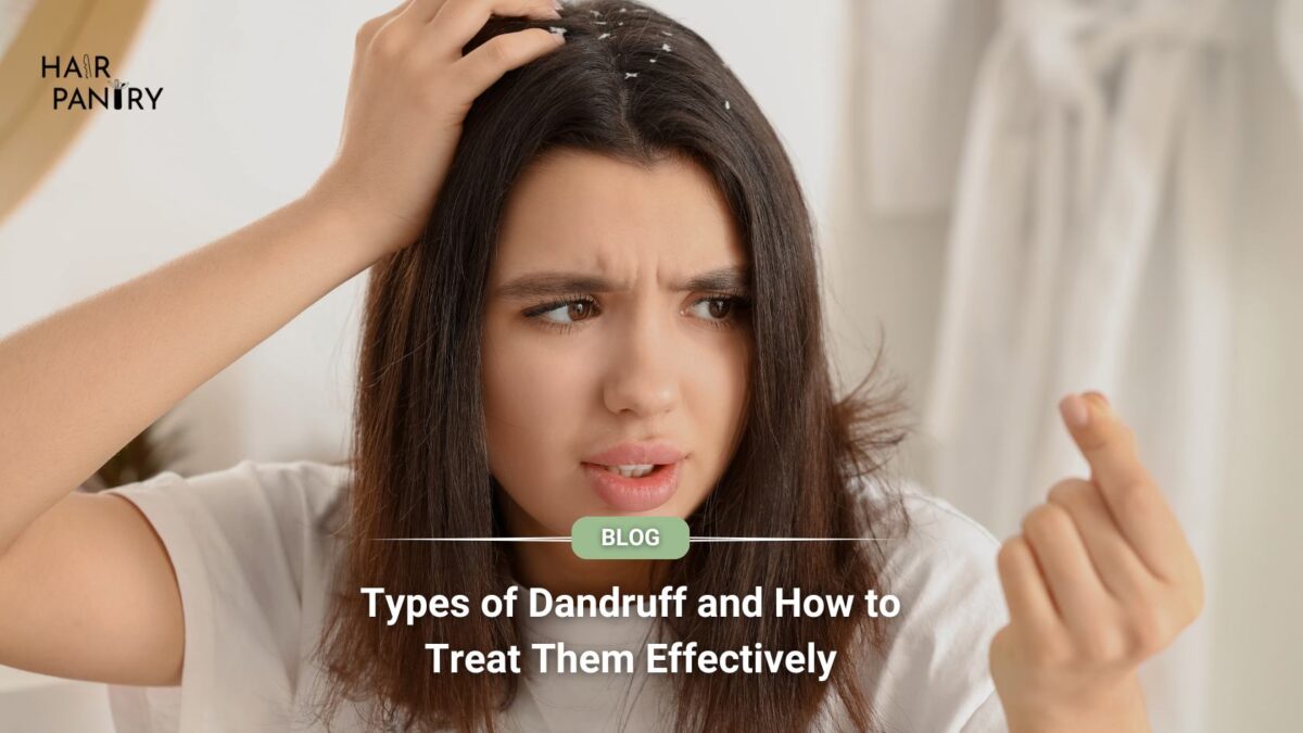 Types of dandruff and how to treat them effectively