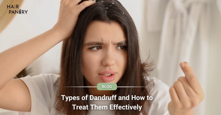 Types of dandruff and how to treat them effectively