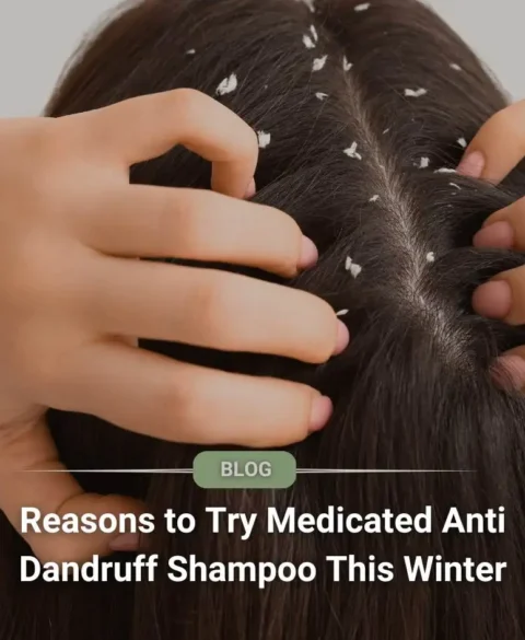 Top Reasons to Try Medicated Anti Dandruff Shampoo This Winter