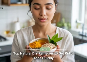 Natural DIY Remedies to Get Rid of Acne Quickly