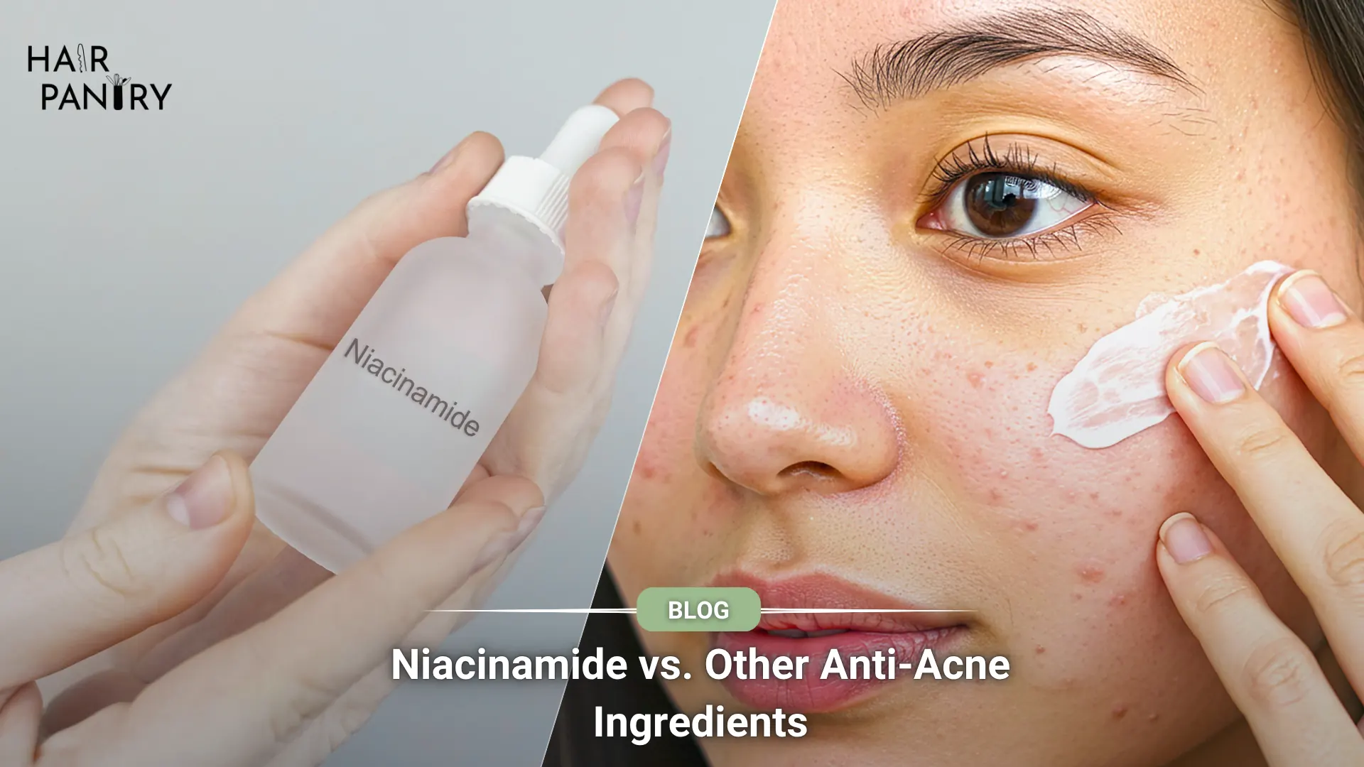 daily-skincare-routine-for-oilyacne-prone-Skin